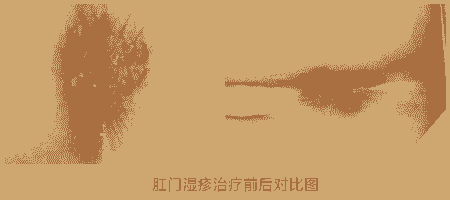 ҽأʪӺζ-lni