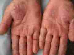 ݱƤר רҵʪ-lni