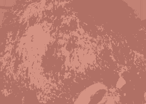 ֬Ƥ׵ľ֢״-lni