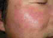 չƤҪǮ-lni