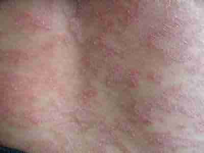 õ�忷���Σ������Щ-lni