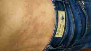 õ�忷��Ĳ�����ʲô-lni