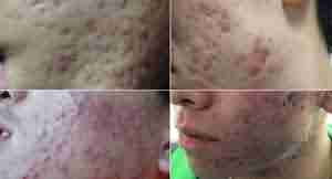 ���ʡǮ���ԣ������ٻ�ԩ��Ǯ-lni