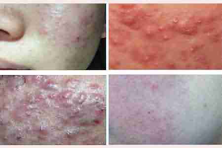 ���ݱ���רҵ��� Ч������-lni