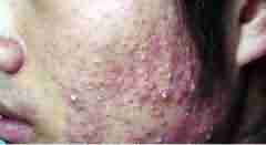 �۴���ô����-lni