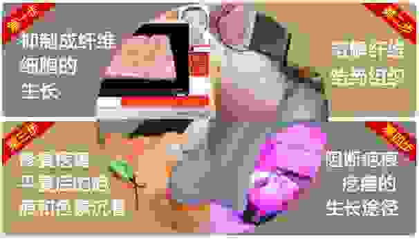 ӶӡЩʲôΣ-lni