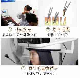 脱发知识 你不得不知-lni