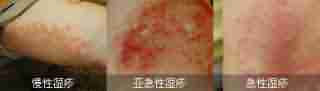 ʪ Щ㲻ò֪-lni