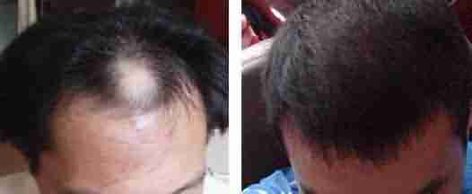 ʲô�ǰ�ͺ����������εú�-lni