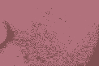 面部过敏的病因是什么-lni