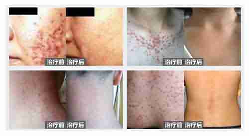 ��������ë����Ҫ����Ǯ-lni