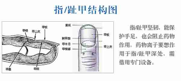 治疗甲沟炎的费用要多少-lni