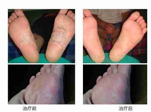 ��Ч��������Ѣ �����������ݱ���Ƥ��ר��-lni