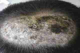 头癣有哪些症状-lni