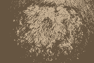 头癣有哪些症状-lni