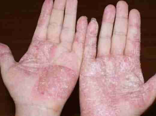 ��Ѣ��ô���ƺ�-lni