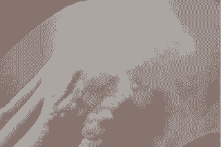 ��Ѣ��֢״����Щ-lni