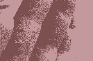 ��Ѣ��֢״����Щ-lni