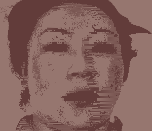 ��Ѫ˿��֢״����Щ-lni