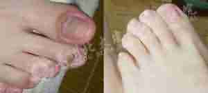 ��ʶ��Ѣ֢״����������Ч����-lni