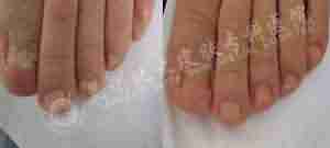 ����98%��Ѣ����ѡ�������ݱ���Ƥ��ר��-lni