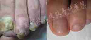 ����98%��Ѣ����ѡ�������ݱ���Ƥ��ר��-lni