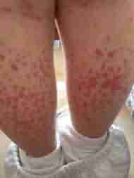 ����������Σ������Щ-lni