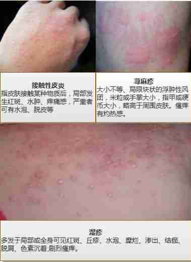 �����ԭ��Ҫ����Ǯ-lni