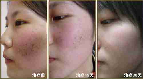 ����ȸ����Ҫ����Ǯ-lni