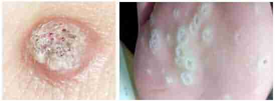 ��������������Ҫ����Ǯ-lni