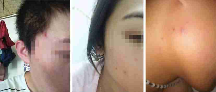 �ഺ���ٿ�-lni