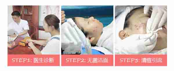 �ഺ���ٿ�-lni