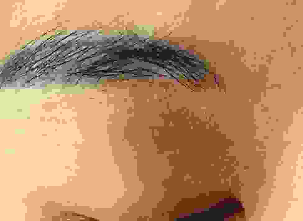 ѯƤ⣬ҽ-lni